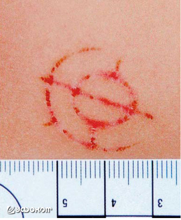 Seifert2010_Article_ViolenceAgainstChildrenFurther-4.jpg